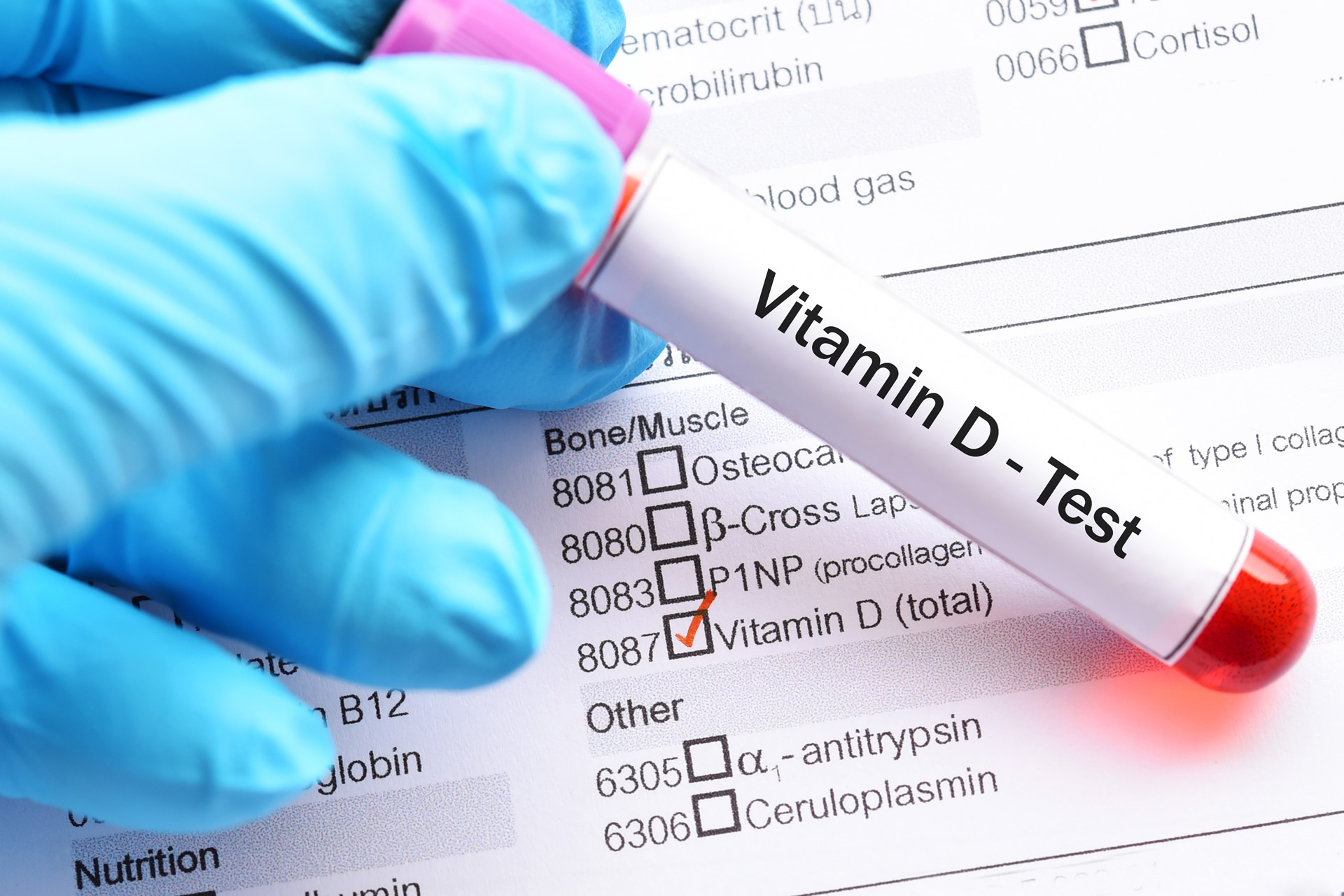 test vitamina d in farmacia