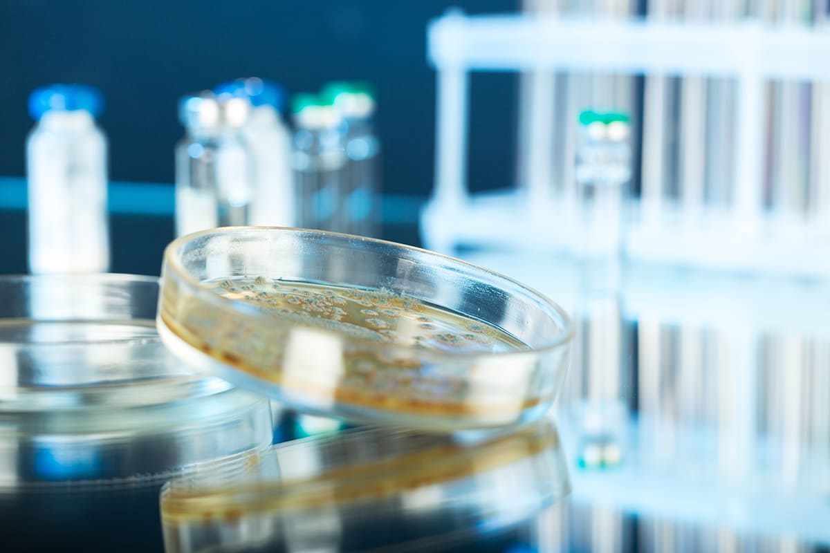 Farmacie Desenzani coprocoltura shighella campylobacter