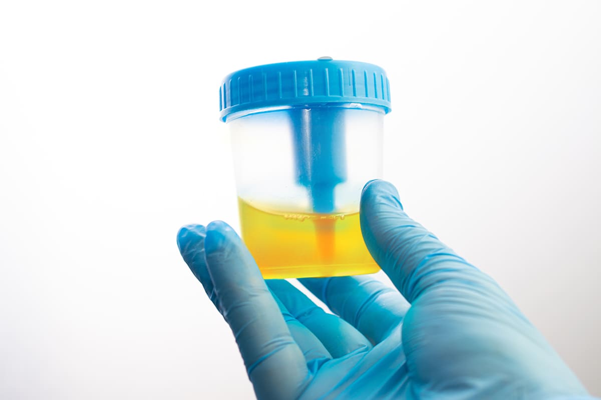 Farmacie Desenzani servizio esame urinocoltura con antibiogramma