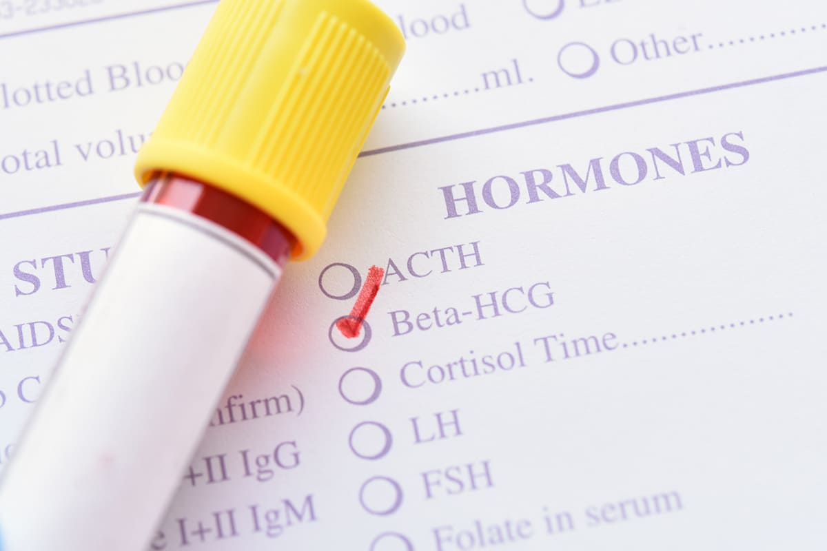 Farmacie Desenzani servizio Dosaggio Beta Hcg