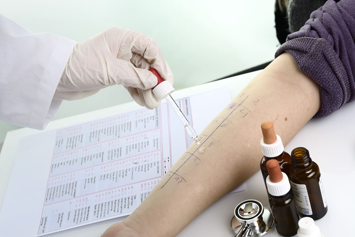 Farmacie Desenzani Servizio Test allergie IGE mediate 300